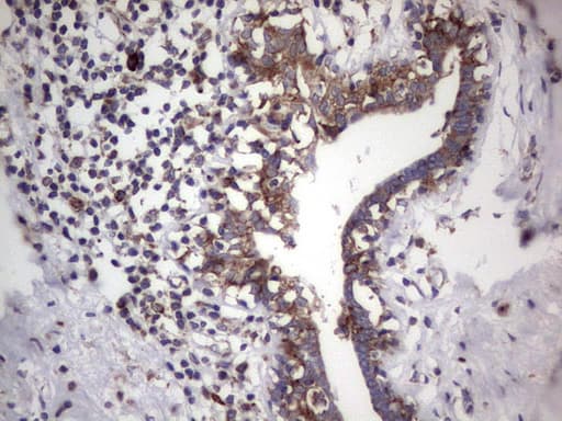LGALS3 / Galectin 3 Antibody (clone OTI6E1)