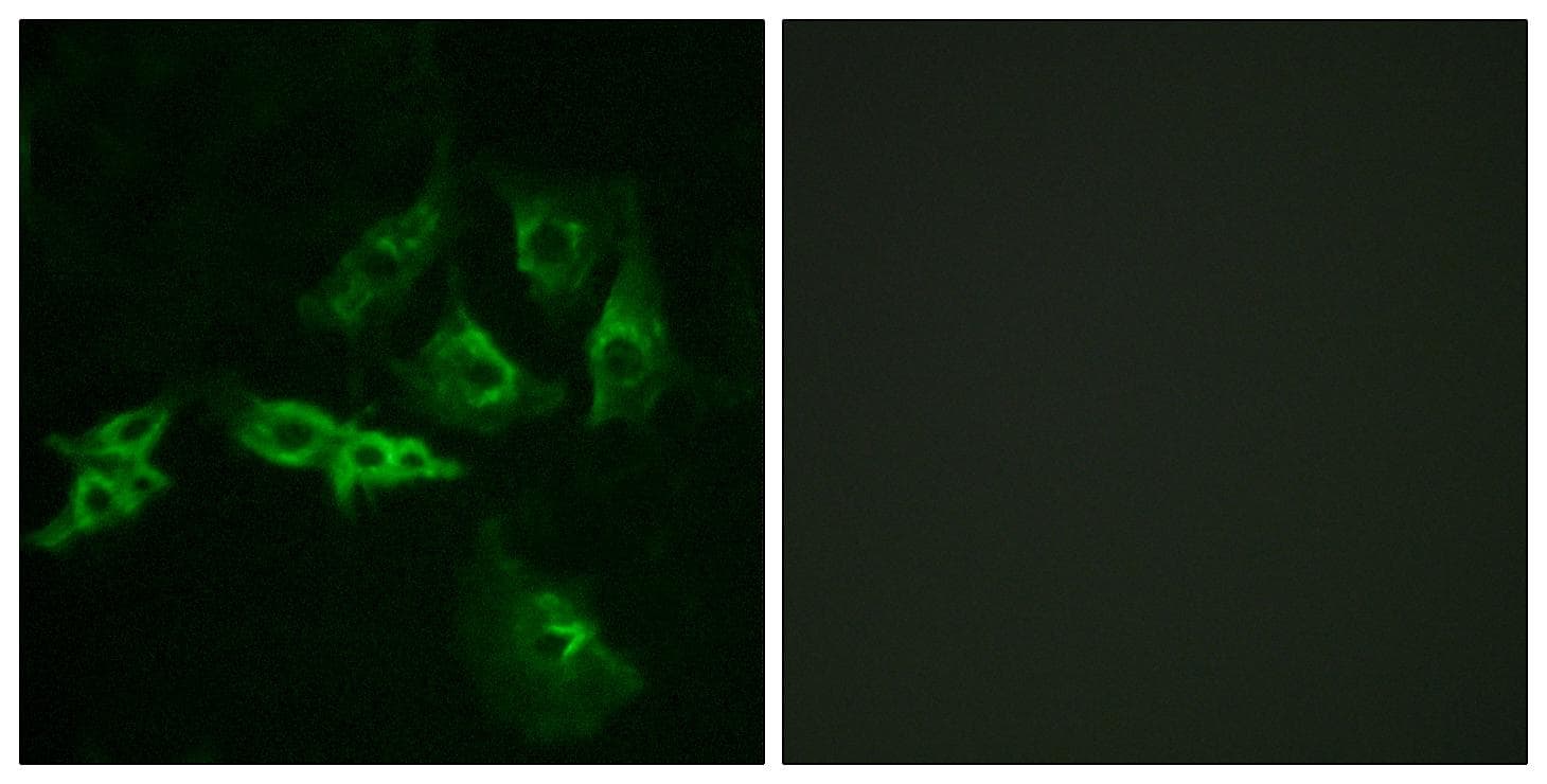 GnRH receptor / GNRHR Antibody