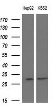 SNRPB2 Antibody (clone OTI3F5)