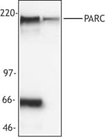 IHC-plus™ Monoclonal Mouse anti-Human CUL9 / Cullin 9 Antibody (clone PO69, IHC, WB)