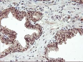 FGF21 Antibody (clone OTI2F10)
