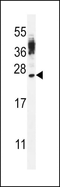 CT45A4 Antibody (aa106-135)