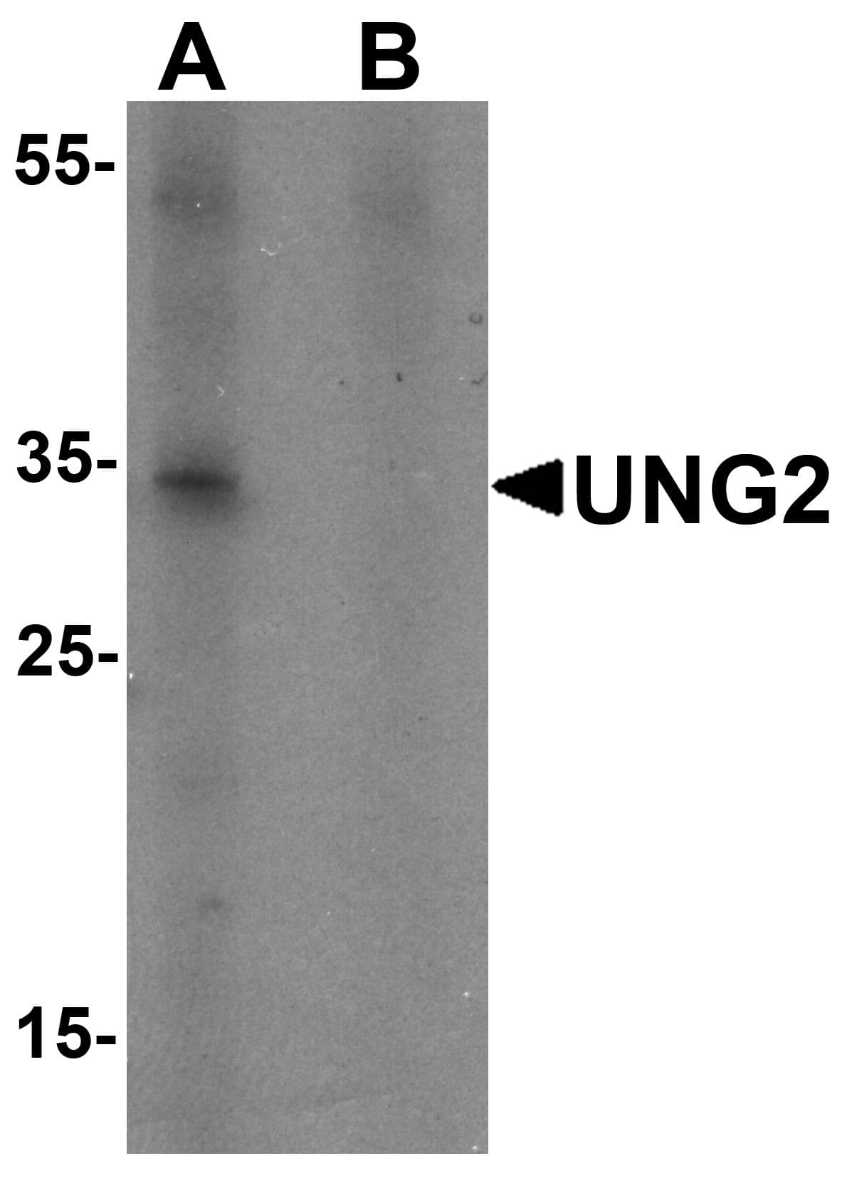 IHC-plus™ Polyclonal Rabbit anti-Human UNG / Uracil DNA Glycosylase Antibody (IHC, IF, WB)