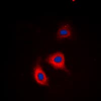 ADD1 / Adducin Alpha Antibody (phospho-Ser726/Ser713)