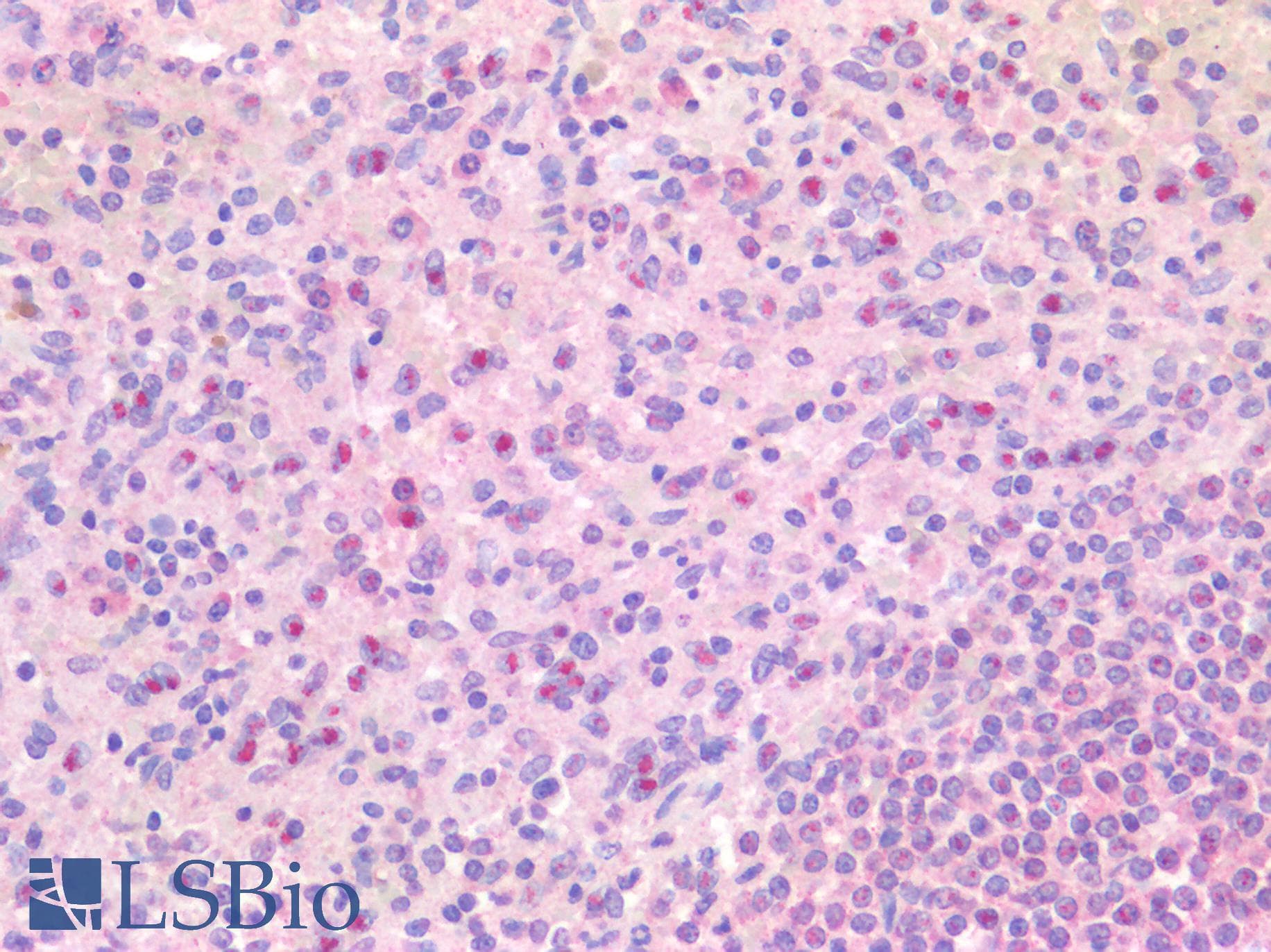 IHC-plus™ Polyclonal Rabbit anti-Human EBI3 / IL-27B Antibody (IHC)
