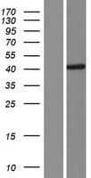 CCDC113 Protein (Over-Expression Lysate Myc-DDK (Flag))