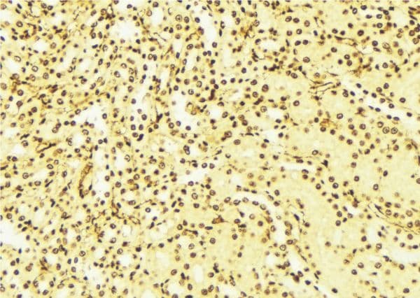 NUDT6 Antibody
