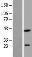 PXMP2 Protein (Over-Expression Lysate Myc-DDK (Flag))