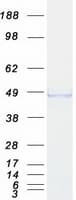 Human ADRM1 Protein (Recombinant Myc-DDK (Flag))