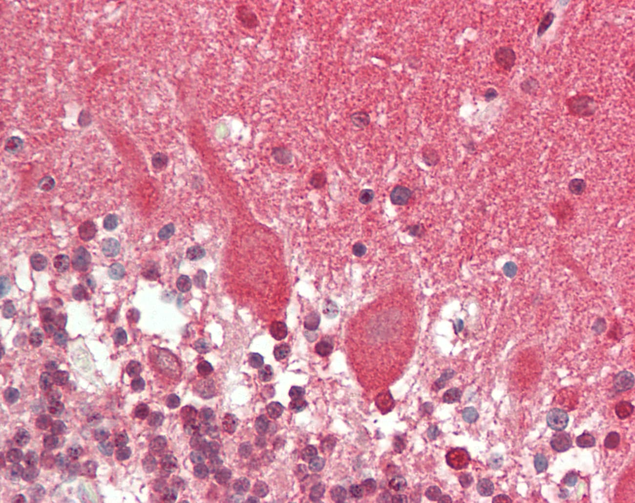 CAMK2B / CaMKII Beta Antibody (C-Terminus)