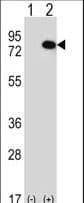 RIOK1 Antibody (aa126-156)