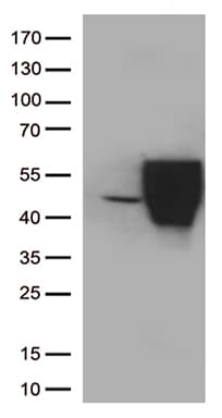 PD-L2 / PDCD1LG2 / CD273 Antibody (clone UMAB223)