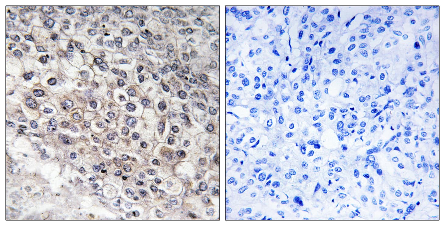 Polyclonal Rabbit anti-Human CYP2W1 Antibody (aa311-360, IHC, IF)
