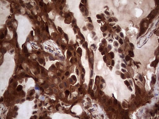 LGALS3 / Galectin 3 Antibody (clone OTI6E1)