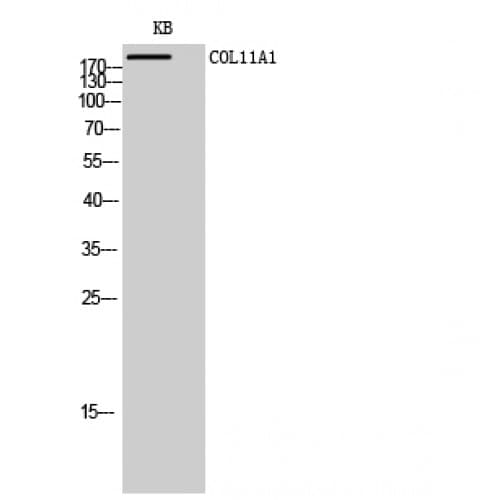 Polyclonal Rabbit anti-Human COL11A1 / Collagen XI Alpha 1 Antibody (550-630 aa, Internal, IHC, IF, WB)