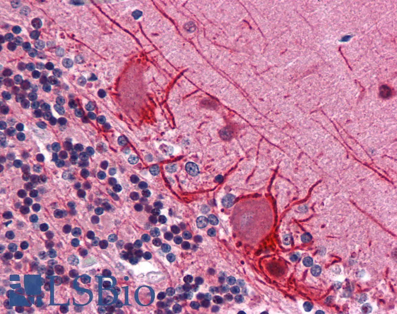 IHC-plus™ RCHY1 / PIRH2 Antibody (clone 1H10)