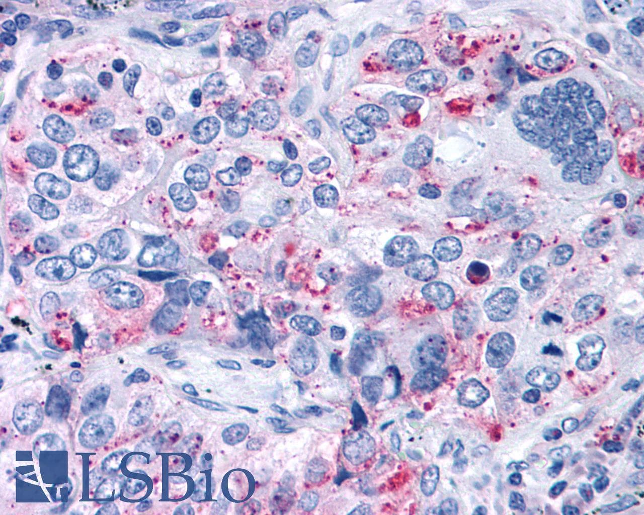 PathPlus™ ADGRG3 / GPR97 Antibody (Extracellular Domain)