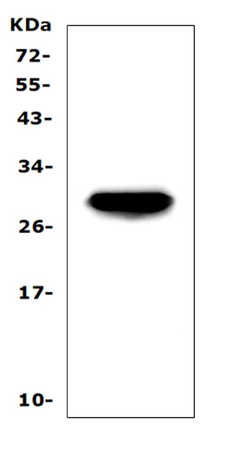 APCS / Serum Amyloid P / SAP Antibody (aa21-224)