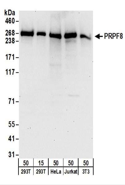 Polyclonal Rabbit anti-Human PRPF8 Antibody (aa850-900, IHC, WB)