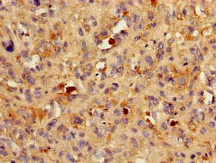 BACE1 / BACE Antibody