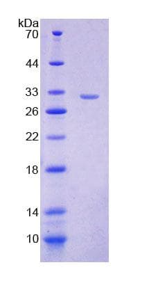 Mouse VARS / ValRS Protein (Recombinant His-T7, N-terminus)