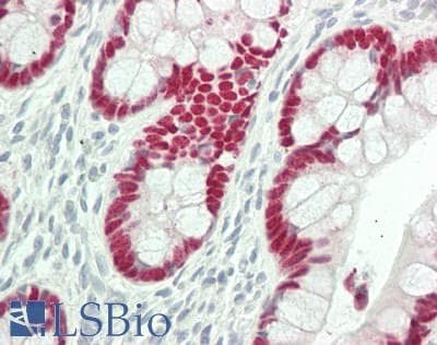 IHC-plus™ CDX2 Antibody (clone 2G5)