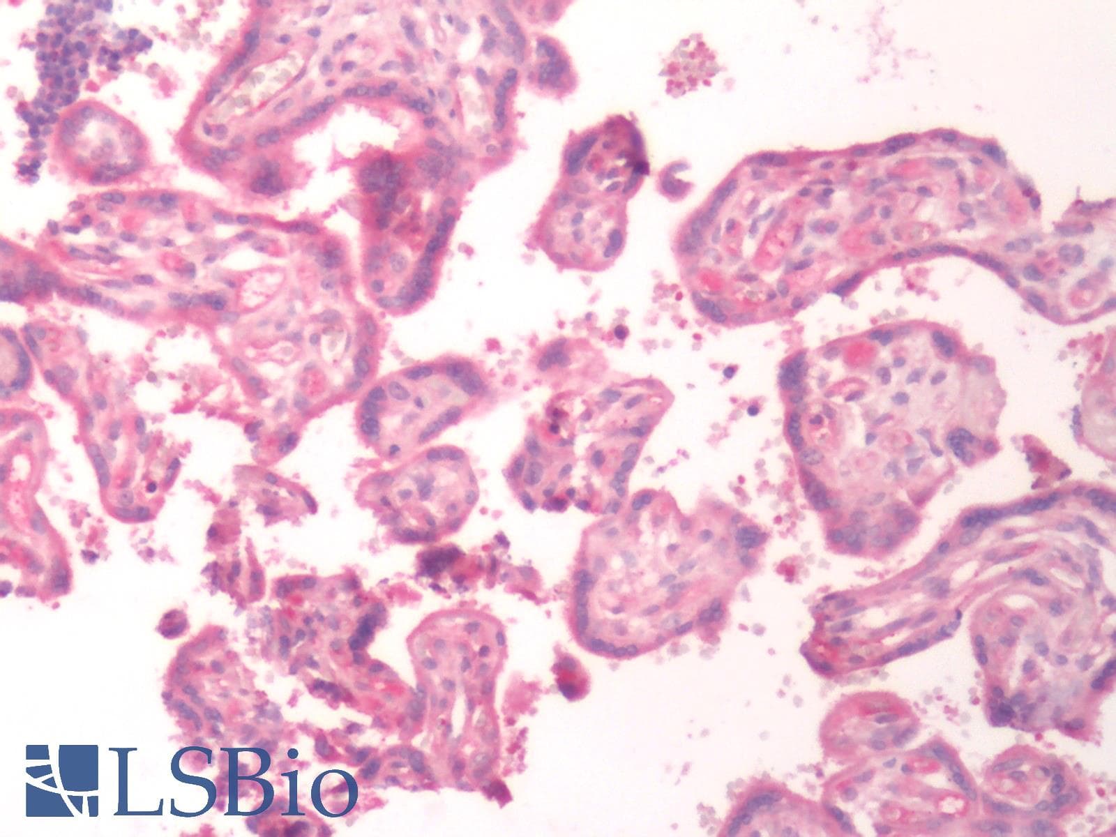 PathPlus™ Polyclonal Rabbit anti-Human B1R / BDKRB1 Antibody (C-Terminus, IHC)