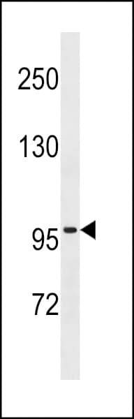 ZNF229 Antibody (aa60-89)
