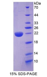 Human MYD118 / GADD45B Protein (Recombinant His-T7)