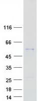 Human SERPINA4 / Kallistatin Protein (Recombinant Myc-DDK (Flag))