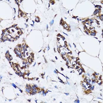 TP53 / p53 Antibody