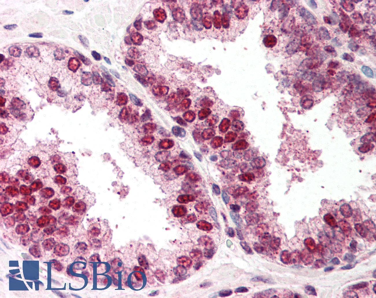 IHC-plus™ RAD52 Antibody