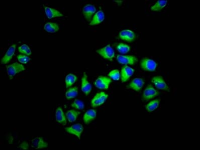 HLA-F Antibody