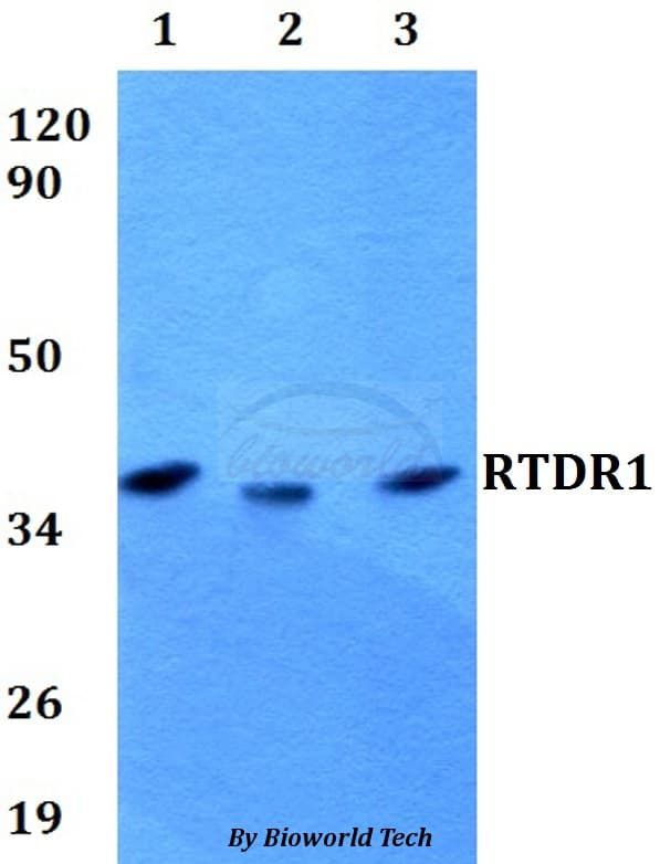 RSPH14 / RTDR1 Antibody