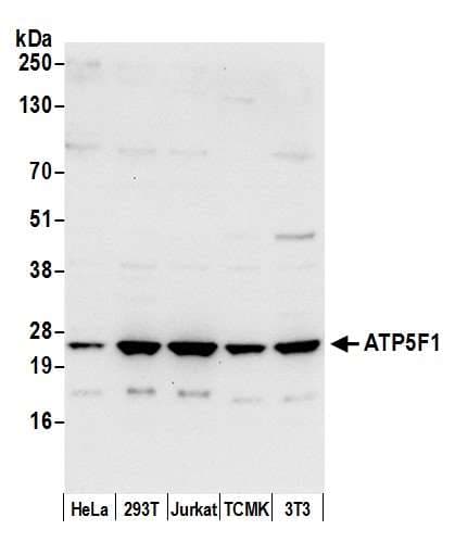 Polyclonal Rabbit anti-Human ATP5F1 Antibody (aa206-256, WB)