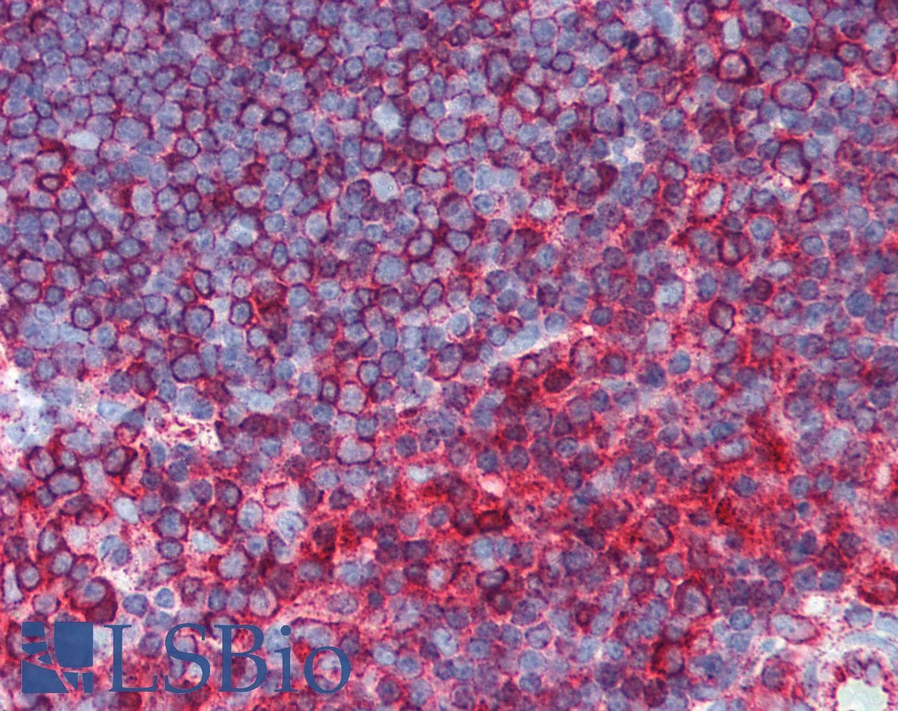 IHC-plus™ TUBB / Beta Tubulin Antibody (N-Terminus, clone 9F3, AF555)
