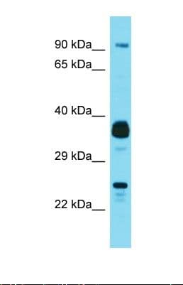JOSD1 Antibody (N-Terminus)