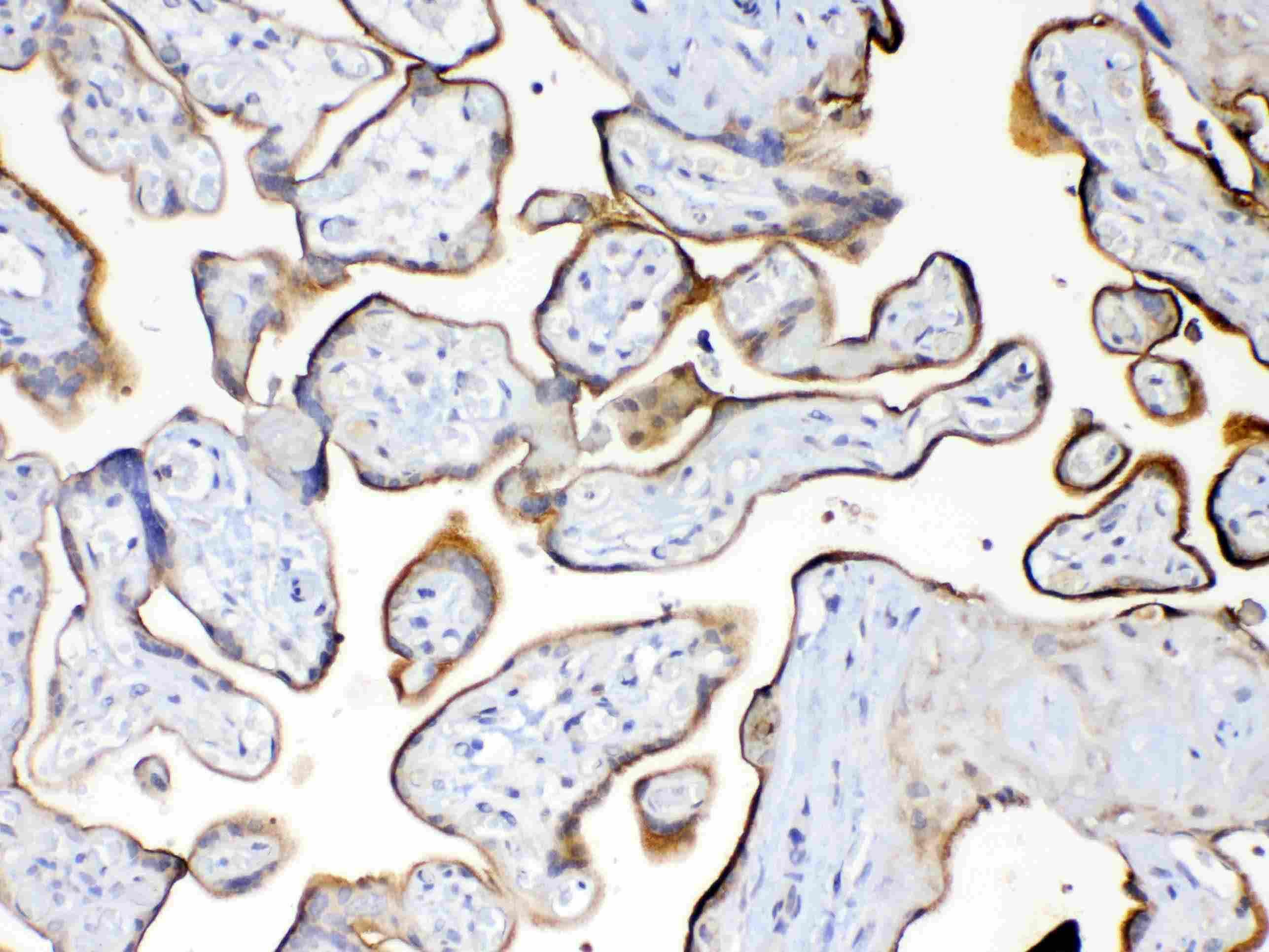 Polyclonal Rabbit anti-Human EMA / MUC1 Antibody (IHC, WB)