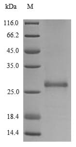 Human GSPT1 Protein (Recombinant 10His, N-terminus)