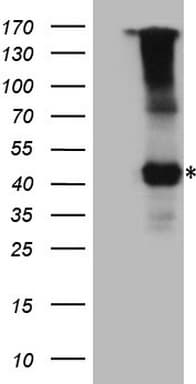 Monoclonal Mouse anti-Human IL12RB1 / CD212 Antibody (clone OTI1A6, aa33-283, WB)