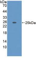ADAMTS7 Antibody (aa447-578)