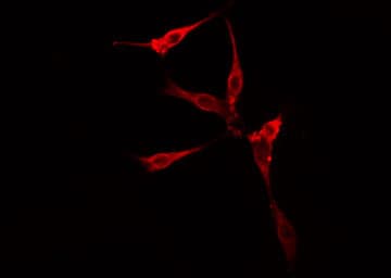 SNCG / Gamma-Synuclein Antibody