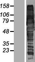 GGA1 Protein (Over-Expression Lysate Myc-DDK (Flag))