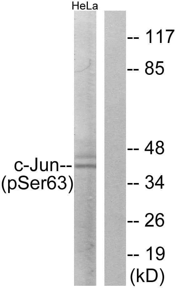 JUN / c-Jun Antibody (phospho-Ser63)