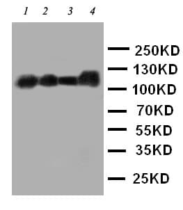 Polyclonal Rabbit anti-Human CEACAM5 / CD66e Antibody (IHC, WB)