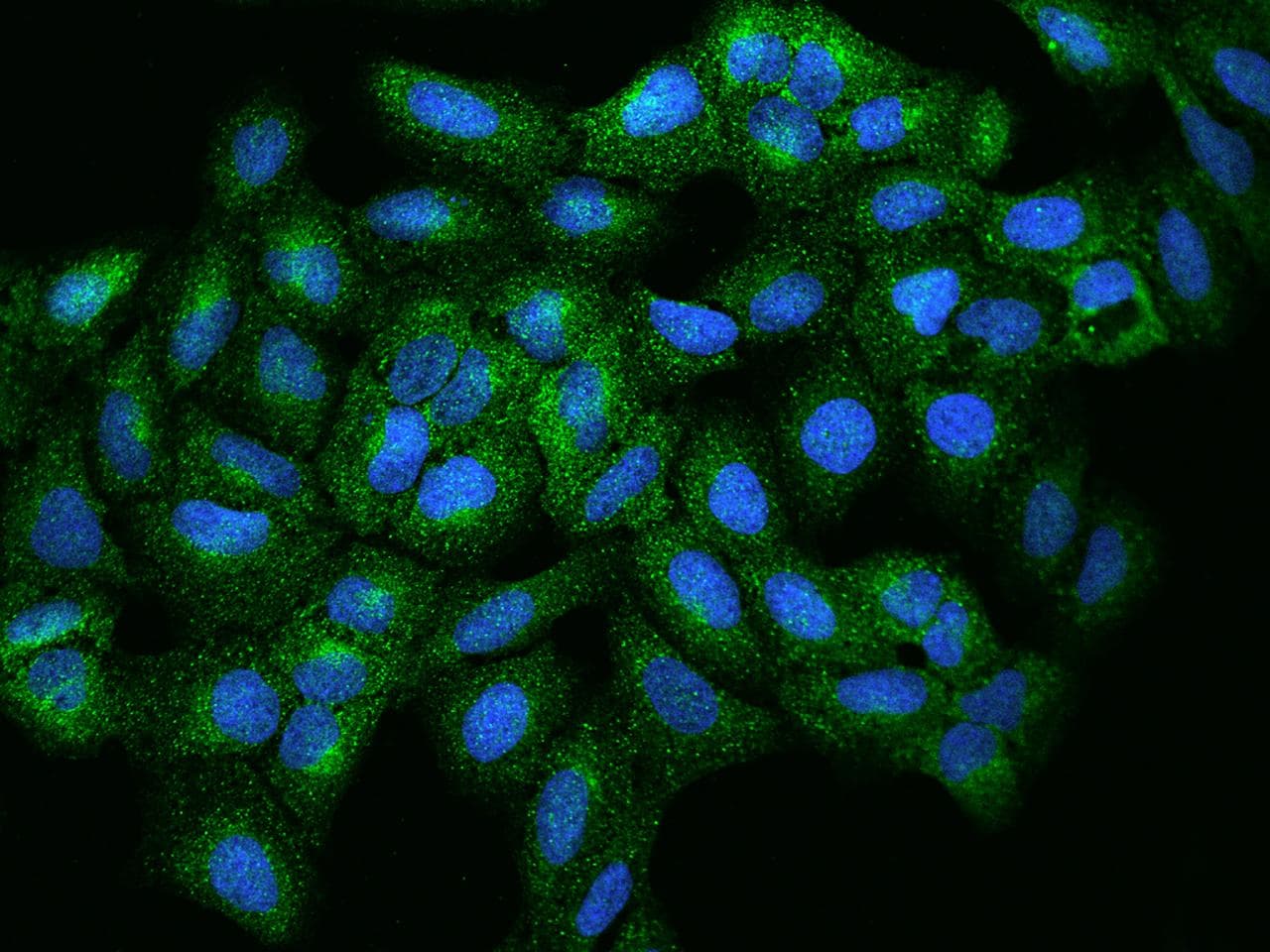 RUNDC3A Antibody