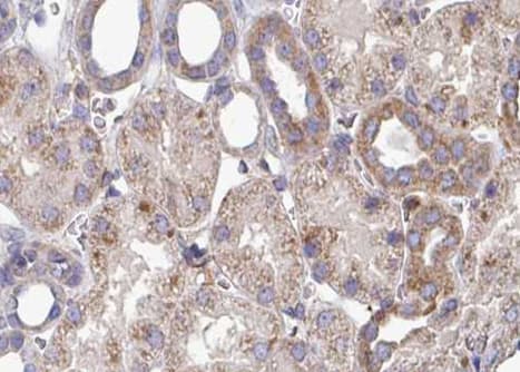 Polyclonal Rabbit anti-Human IFN Gamma / Interferon Gamma Antibody (IHC, WB)