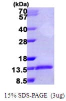 Human CCL3 / MIP-1-Alpha Protein (Recombinant His)