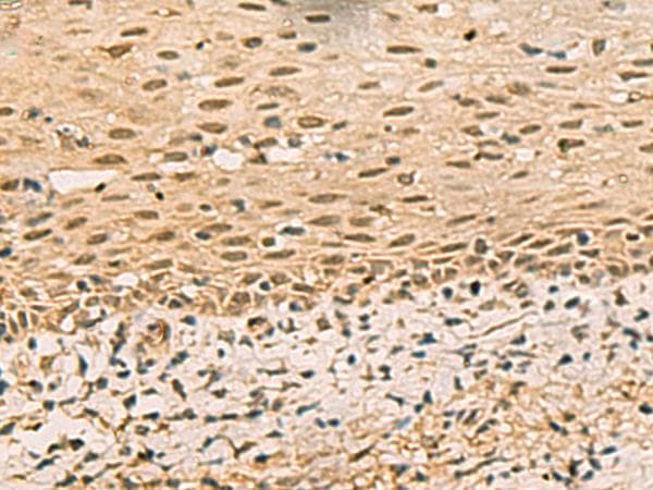 Polyclonal Rabbit anti-Human FOXH1 Antibody (IHC)