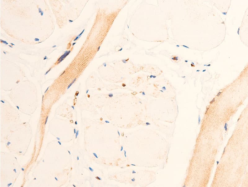 TGFB1 / TGF Beta 1 Antibody
